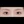 Aegyo-sal filler (under-eye 'love band' / pretarsal roll filler) — after · Pixel Lab Plastic Surgery Clinic