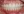 Clippy-C self-ligating ceramic braces (TOMY) — after (356days) · Yonsei Good Day Dental Clinic - Suseo Branch