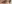 二重まぶた（自然癒着法） — ルホ美容外科クリニック