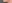 インモードリフト（InMode／FORMA＋MINI FX） — ルアク美容外科クリニック