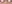 裏ハムラ法（経結膜的眼窩脂肪移動術） — ファクト美容外科クリニック