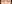 裏ハムラ法（経結膜的眼窩脂肪移動術） — プレジャー美容外科クリニック