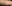 顔の脂肪溶解注射（小顔注射） — ロリポップ美容外科クリニック
