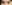眼瞼下垂手術（目つき矯正） — ジェスタ美容外科クリニック