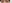二重まぶた（自然癒着法） — ルホ美容外科クリニック