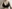 豊胸術（シリコンインプラント／人工乳腺） — エイト美容外科クリニック