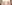 裏ハムラ法（経結膜的眼窩脂肪移動術） — プレジャー美容外科クリニック