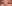 lower blepharoplasty (under-eye bag removal with fat repositioning) — Pleasure Plastic Surgery Clinic