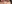 裏ハムラ法（経結膜的眼窩脂肪移動術） — プレジャー美容外科クリニック