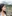 ผ่าตัดแก้จมูกบาน (ลดขนาดปลายจมูก) — คลินิกเสริมความงามชาร์ป (Sharp)