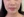 Oligio / Oligio X (โอลิจิโอ) — ก่อนทำ (30วัน) · คลินิก Look At Me