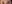 眉毛挙上術（ブロウリフト） — エイペックス美容外科クリニック