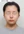 two-jaw surgery (bimaxillary orthognathic surgery) — after (90days) · A-Top Plastic Surgery Clinic