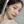 ผ่าตัดลดโหนกแก้มแบบเร็ว (ไม่ใส่ตัวยึด) — ก่อนทำ (90วัน) · ยูโนพลาสติกเซอร์เจอรี่