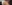 顔全体の脂肪注入（フルフェイス脂肪移植） — ファクト美容外科クリニック
