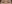 Anterior cheekbone fat grafting — Midline Plastic Surgery Clinic