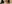 人中短縮（リップリフト） — ハイボム美容外科クリニック