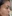 Juvelook (PDLLA + HA collagen-stimulating skin booster) — Ruby Clinic