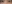 裏ハムラ法（経結膜的眼窩脂肪移動術） — アンド美容外科クリニック