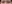 二重まぶた（自然癒着法） — プロミス美容外科クリニック