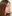 鼻尖形成術（自家軟骨移植） — ハイエンド美容外科クリニック