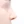 Nasal osteotomy (nasal bone narrowing) — after (7days) · Sugar Plastic Surgery