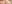 裏ハムラ法（経結膜的眼窩脂肪移動術） — ウリ美容外科クリニック