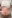 Abdominoplasty (tummy tuck) — Tangl Plastic Surgery Clinic