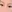 buried suture (non-incisional) double eyelid surgery — Yellow Plastic Surgery Clinic