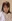 二重あごの脂肪吸引（顎下脂肪吸引） — ジェリム美容外科クリニック