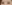 二重まぶた（自然癒着法） — プロミス美容外科クリニック