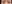 下眼瞼下制術（グラマラスライン形成・たれ目形成） — プロミス美容外科クリニック
