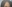 額縮小術（生え際下げ・ヘアライン下降術） — ザフィックス美容外科クリニック