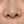 Chemical peel — before (28days) · J.Fill Clinic - Gangnam Branch
