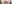 口唇縮小術（厚い唇を薄くする手術） — エイペックス美容外科クリニック