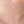 PRP skin rejuvenation (platelet-rich plasma therapy) — after (21days) · Only Lift Clinic