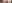 二重まぶた（自然癒着法） — ルホ美容外科クリニック