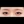 Aegyo-sal filler (under-eye 'love band' / pretarsal roll filler) — after · Pixel Lab Plastic Surgery Clinic