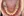 Clippy-C self-ligating ceramic braces (TOMY) — before (194days) · Lucent Dental Clinic