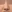 鼻尖形成術（自家軟骨移植） — マーブル美容外科クリニック