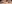 二重まぶた（自然癒着法） — プロミス美容外科クリニック