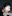 鼻尖形成（自體軟骨） — 麒麟醫美診所