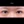 ผ่าตัดแก้ขนตาทิ่มตา (ขนตาแยงตา / เปลือกตาม้วนเข้า) — หลังทำ (14วัน) · รพ.ศัลยกรรมตกแต่งโอลโล
