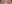 二重まぶた（自然癒着法） — プロミス美容外科クリニック