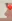 Bulbous nose correction (surgical nasal tip reduction) — Eight Plastic Surgery Clinic