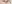裏ハムラ法（経結膜的眼窩脂肪移動術） — ファクト美容外科クリニック