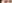 眼瞼下垂手術（目つき矯正） — IK美容外科クリニック