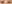 切開法（全切開法二重術） — アイニーク美容外科クリニック