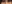 裏ハムラ法（経結膜的眼窩脂肪移動術） — ファクト美容外科クリニック