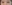 二重まぶた（自然癒着法） — プロミス美容外科クリニック